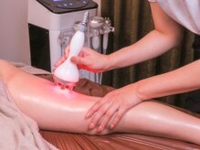 ベルミナ(Belmina)/キャビテーション