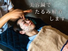 「しみ」「たるみ」「くすみ」でお悩みの方へ美容鍼を♪