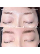 スウィートアイズ(Sweet eyes)/ハリウッドブロウリフト