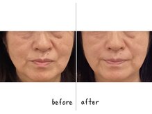 シフク鍼灸整体院/５０代(加工なし)