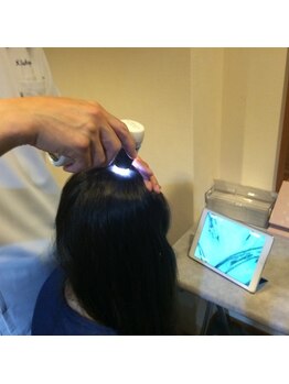 レメディ/育毛促進鍼