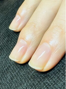 爪の悩みを解消できる（ケア含む）