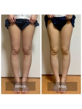 リノリー(rinory)/すっきり！