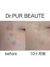 イスタナ ロゼ/Dr.PUR BEAUTE