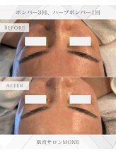 モネ オキナワ(MONE okinawa.)/ハーブボンハ゛ー