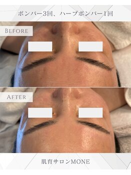 モネ オキナワ(MONE okinawa.)/ハーブボンハ゛ー