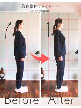 ヨギート(yogate)/経絡リンパマッサージ/整体/小顔