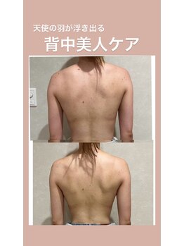 リエイト(Lieto)/背中から整える花嫁さま特別ケア