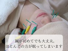 当日効果実感される方の多い電気美容鍼です♪