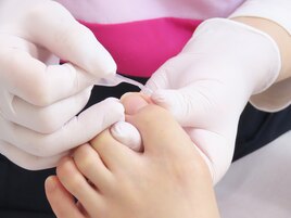 足や足爪のトラブルを改善