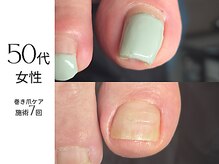 フットケア クラッシー(footcare classy)