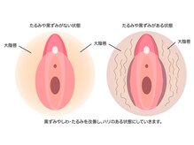 カナウ(KANAU)/VIO脱毛で黒ずみ解決！