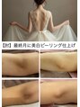 ボーテドリッシュ(Beaute de Riche)&nbsp;人気No.3肘/膝 99000円美白ピーリング仕上げ 肘は特に人気です