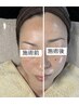 【ハーブピーリング】ご予約2回目の方限定クーポン 選べるツヤハリ白玉肌