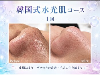 リベルテの写真/毛穴レスな陶器肌を目指すケアで、皮脂詰まりやザラつきの改善をサポートします☆