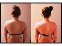 アユナタ(Ayu Natah)/ブライダルエステで痩せました