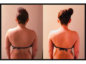 アユナタ(Ayu Natah)/ブライダルエステで痩せました