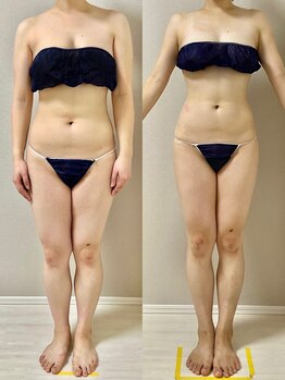 ウム 四ツ橋店(umu)/セルゼロの仕上がり