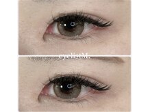 ディーグレース(D.Grace)/バインドロック