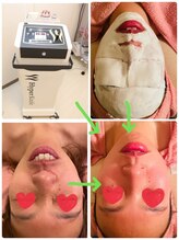 シャインクラフト/