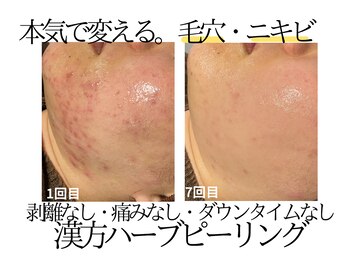 おうちサロン ミキ