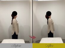 リン 大宮院(RIN)/骨膜整体での変化（担当：青野）