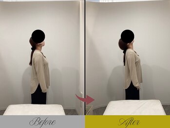 リン 大宮院(RIN)/骨膜整体での変化（担当：青野）