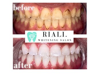リアリ(RIALI.)の写真/都度払いOK☆だから自由に通える♪完全個室でリラックスしながらキレイをアップデート＊。