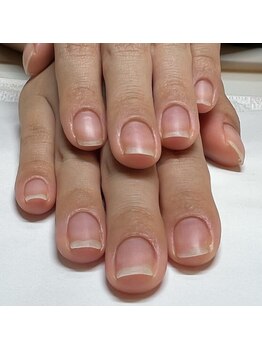 マリーロール 梅田店(Marie Laure)/自爪育成/深爪矯正/ネイルケア