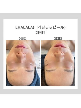 ポムハヌル(pom.haneul)/韓国肌管理室