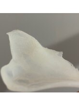 ルブール(levure)/小鼻の黒ずみは産毛かも