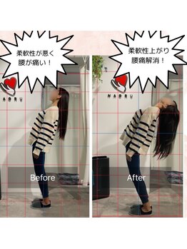 ナオル整体 銀座院(NAORU整体)/腰痛改善　before after