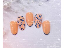 ブロッサム(Blossom)/