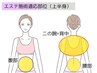 【背中/二の腕・下腹・加齢太り】美骨盤矯正+痛みの少ないキャビ3部位¥4980
