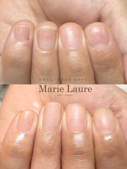 マリーロール 淀屋橋本店(Marie Laure)/自爪育成/深爪矯正/ネイルケア