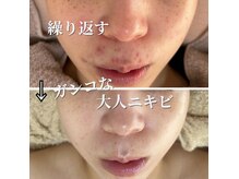 セリー(Celie)の雰囲気（繰り返しできるニキビのケアも必ず良くなる方法を導きます♪）