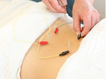 ひびき鍼灸整体院/鍼灸　腰痛改善に