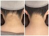 【お得3回セット】うなじ脱毛トライアル3回