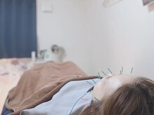 ハリヒト 横手(HALicht)の雰囲気（美容鍼と美容液で肌細胞の活性化◎）