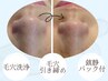 【バージョンアップ毛穴洗浄】鼻のみ