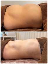 ヨロ(YOLO)/パーソナルボディケア90分