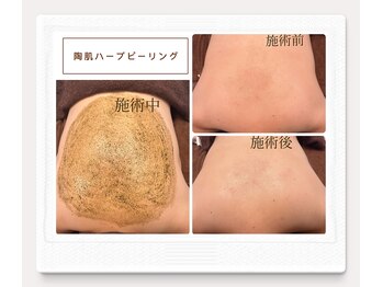 ルル リラクゼーション(RURU Relaxation)/ハーブピーリング/ボディ