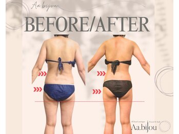 エイエービジュー(Aa.bijou)