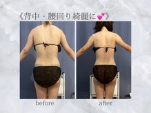 ジュプン 長崎/姿勢改善で背中スッキリ！