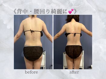 ジュプン 長崎/姿勢改善で背中スッキリ！