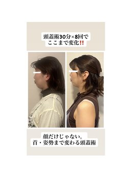 ボディスマイル(Body Smile)の写真/頭から全身へ巡る癒しを。10万人の施術から生まれた！ヘッドケアで全身が緩む、“唯一無二のヘッドスパ”