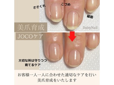 爪ケアのプロが美爪育成JOCOケアでお爪のトラブルを徹底ケア☆