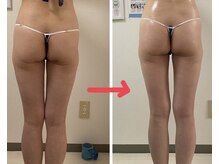 シャインクラフト/