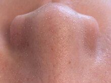 ヒスイ バイ アメイジング(Hisui by AMAZING)/【毛穴ケア】韓国式3D毛穴洗浄