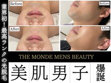 どこよりも効果を実感！人気急上昇中メンズ脱毛